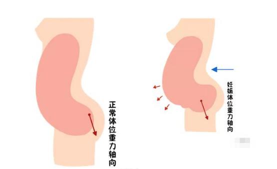 盆底恢復(fù)是否可以使用儀器？