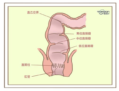 盆底康復(fù)治療儀對產(chǎn)后便秘有哪些幫助？